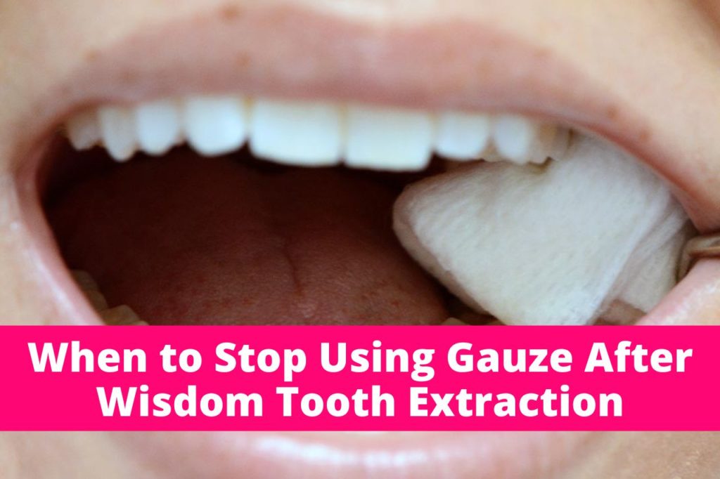 When to Stop Using Gauze After Wisdom Tooth Extraction BeautyPapa